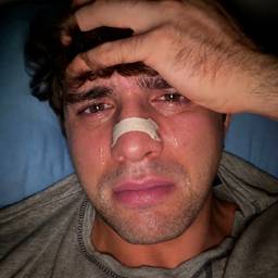 After - Crying Face Photo Edit