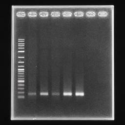 Gel Electrophoresis Fix