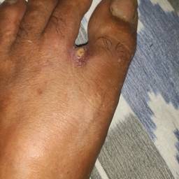 Add Injury To Hand Photo AI - Free Online Tool | ImageGPT