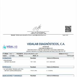 Avant - Supprimer le code QR d'un document