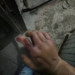 Depois - Edição de Dedo Quebrado Falso