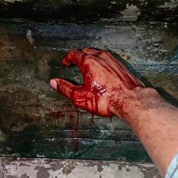 Bloody Hand Photo Edit