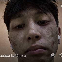 Après - Retouche subtile de maquillage zombie