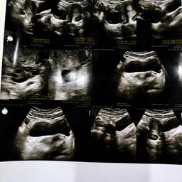 Ultrasound Report Date Edit