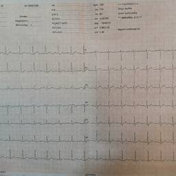 ECG Date Edit