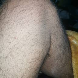 Antes - Edição de Foto Realista de Hematoma