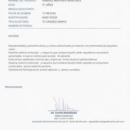 Clean Document Stains AI
