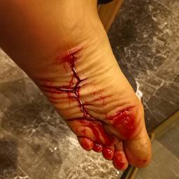 After - Realistic Blood Injury Effect
