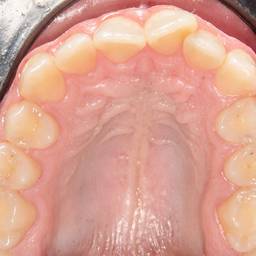 After - Brighter Dental Photo Edit