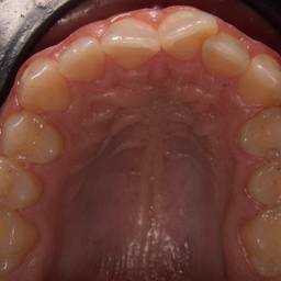 Before - Brighter Dental Photo Edit