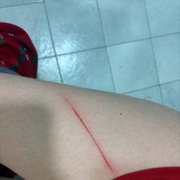 Deep Scratch Photo Edit