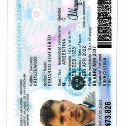 Après - Améliorateur de Scan de Carte d'Identité