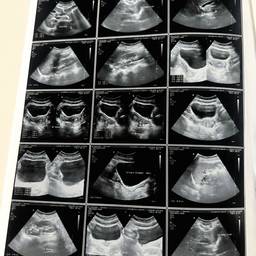 Ultrasound Report Date Edit