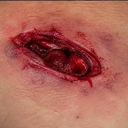 Hyperrealistic Fake Wound Art