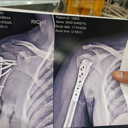 X-Ray Report Date Edit