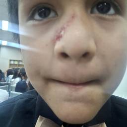 Fake Cut on Nose