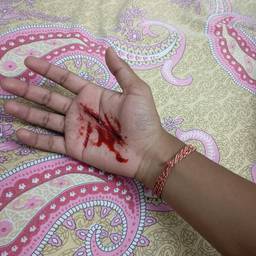 Realistic Palm Wound Edit
