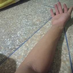 Before - Realistic Arm Wound Effect