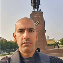 Antes - Suavizar las arrugas del entrecejo