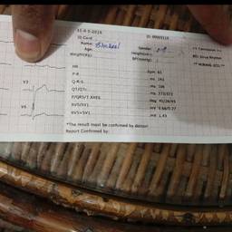 ECG Report Date Edit