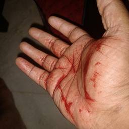 After - Bloody Hand Photo Effect