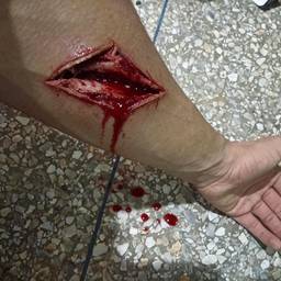 After - Realistic Fake Wound Edit