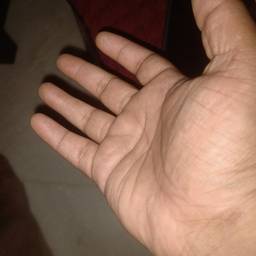 Before - Bloody Hand Photo Effect