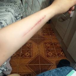 Realistic Scratch Wound