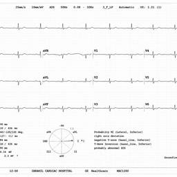 Après - Modifier la Date d'ECG