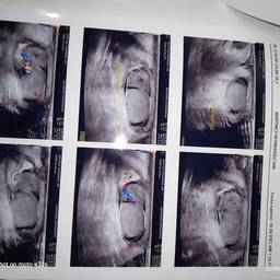 Ultrasound Report Date Edit