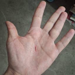 Realistic Fake Hand Wound