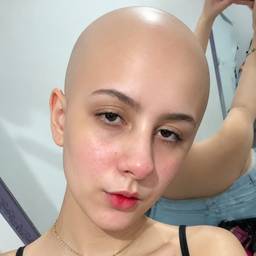 Bald Head Photo Edit