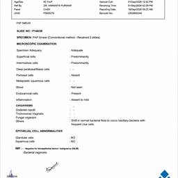 Straighten Document Scan